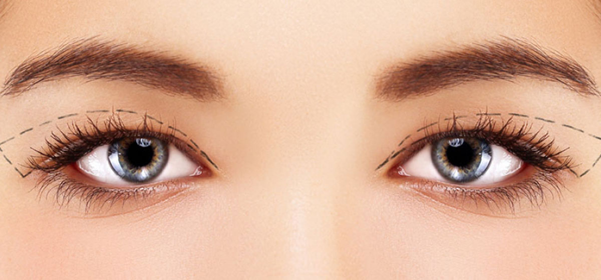 Oculoplasty Services
