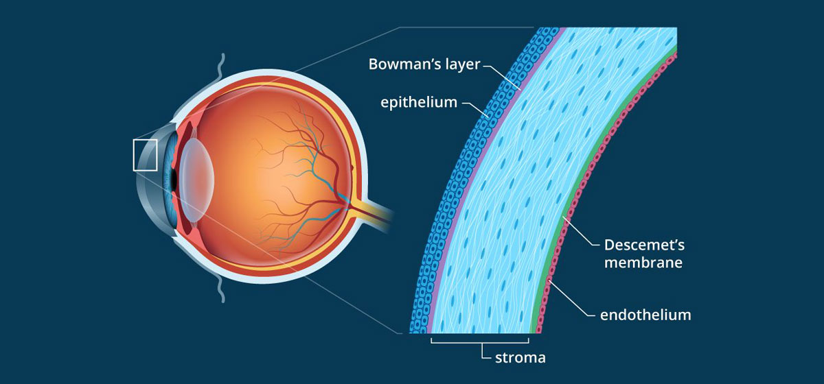 Corneal Services