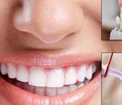 Cosmetic Dentistry