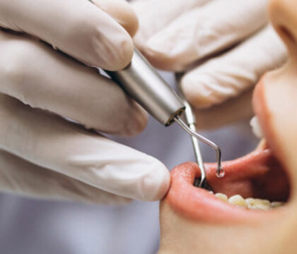 Dental Treatments