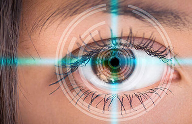 Retinal Lasers